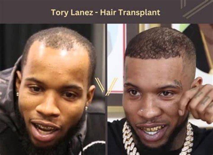 How Much Time Did Tory Lanez Get?